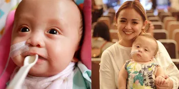 Menderita Penyakit Langka, Anak Joanna Alexandra - Raditya Ditangani 10 Dokter