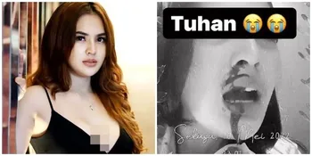 Mengaku Terkena Santet, Hidung dan Mulut Iqlima Kim Mantan Asisten Hotman Paris Terus Mengeluarkan Darah