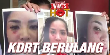 Nindy Ayunda Akhirnya Buka Suara, Bawa Bukti KDRT