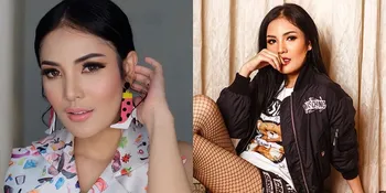 Pakai Jepit Rambut Berjejer, Nindy Kembali Tampil Unik dan Jadi Perhatian!