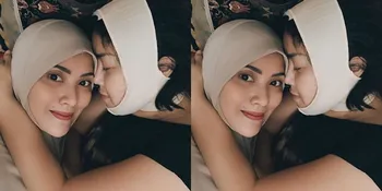 Pasang Filler 2 Tahun Lalu, Rency Milano Sempat Komplain Langsung ke Klinik Setelah Dagunya Bernanah