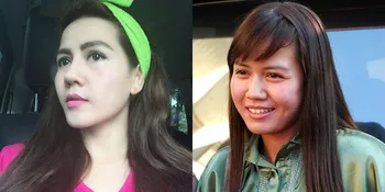 Pedangdut Nita Thalia Buka-Bukaan Mengaku Oplas, Apa Alasannya?