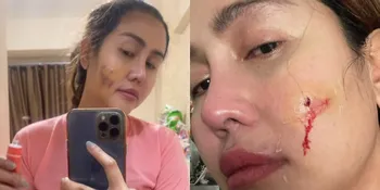 Pedangdut Ratu Meta Unggah Video Cekcok dengan Suami, Ungkap Kekerasan yang Diduga KDRT