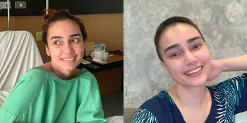 Penampilan Terbaru Feby Febiola Jadi Sorotan, Kini Rambutnya Botak Setelah Jalani Kemoterapi