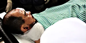 Pengamat Musik: Pelaku Penyiraman Beery Saint Loco Biadab!