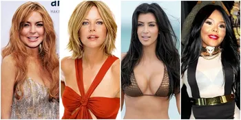 Perubahan Drastis Wajah 12 Artis Hollywood, Operasi Plastik?