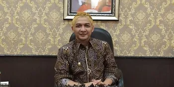 Perut Buncit Jadi Salah Satu Alasan Utama Pasha Ungu Cat Rambut Jadi Blonde