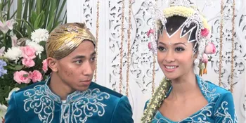 Poppy Bunga Ikutan Sulam Alis Biar Suami Makin Cinta!