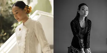 Potret Cantik Dhika Himawan, Calon Istri Brandon Salim: Elegan, Ceria, dan Berkelas!