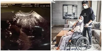 Potret Krisdayanti Pasca Aurel Keguguran, Terus Dampingi ke Dokter Kandungan Sambil Terus Berdoa