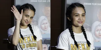 Rajin Pakai Masker Selama Pandemi Covid-19, Wajah Michelle Ziudith Sampai Jerawatan