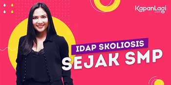 Sejak SMP Idap Skoliosis, Jessica Mila Diharuskan Pakai Baju Khusus Selama 22 Jam Setiap Hari