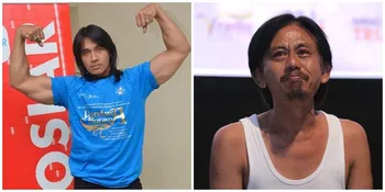 Selain Agung Hercules, 2 Seleb Tanah Air Ini Juga Terkena Penyakit Otak
