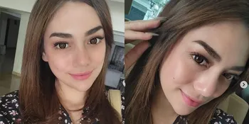 Selfie Tanpa Filter, Ini Potret Wajah Asli Celine Evangelista yang Curi Perhatian