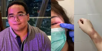 Sepupu Calon Istri Fritz Hutapea Jadi Korban KDRT, Pelaku Sudah Ditetapkan Jadi Tersangka