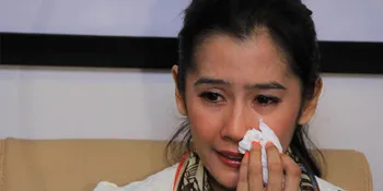 Sering Dijambak Eza, Rambut Ardina Rasti Rontok