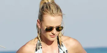 Tampil Seksi, Model Ini Malah Terlihat Menyakitkan