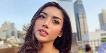 Tanggapan Ashanty Soal Millendaru Lakukan Implan Payudara