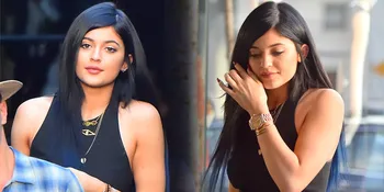 Terkuak! Bibir Sensual Kylie Jenner Ternyata Hasil Lip Injection