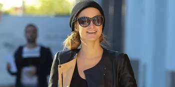 Ternyata Rambut Paris Hilton Mulai Botak!