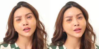 Terungkap! Ini Alasan Sarwendah Operasi Plastik di Korea Selatan, Bantah Endorse Tapi Dapat Diskon Karena Ketahuan Artis