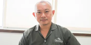 Transplantasi Rambut, Verdi Solaiman Ingin Tampil Ekstrem Demi Peran