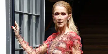 Tubuhnya Dibilang Kurus Kering, Celine Dion Akhirnya Beri Tanggapan