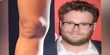 Unik, Lutut Miley Cyrus Mirip Wajah Seorang Aktor