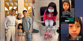 Vania Adik Verrell Bramasta Jadi Korban Bully, Mata Dilempar Sampai Bengkak