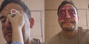 Wajah Cemong, Hamish Daud Pasrah saat Didandani Jadi King Teca oleh Zalina sang Putri - Gemes Banget