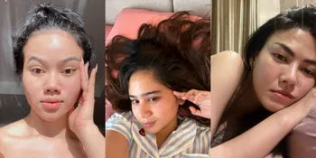 10 Potret Artis Tampil Percaya Diri Pamerkan Bare Face, Tetap Menawan Meski Wajah Berminyak - Jerawatan