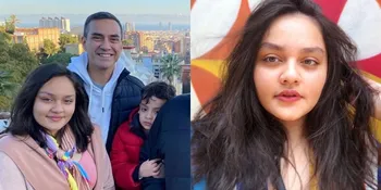 10 Potret Farah Labita, Putri Ferdy Hasan yang Cantik Lulusan Universitas Ternama Dunia