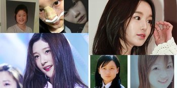 12 Bintang Cantik Korea #NggakTakut Ngaku Oplas di Siaran TV