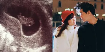 4 Bulan Dinikahi Rudi Ming, Si Cantik Angel Chibi Sudah Hamil?