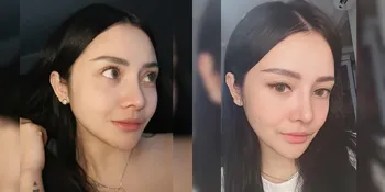 8 Potret Terbaru Mawar AFi yang Malah Kena Cibir Netizen: Bagusan Sebelum Oplas!