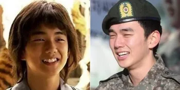 Bukan Oplas, Wajah Artis Korea Sebelum - Sesudah Memperbaiki Gigi