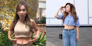 Cherly Juno Bagikan Pengalamannya Lakukan Operasi Tummy Tuck, Sempat Tak Mendapat Izin