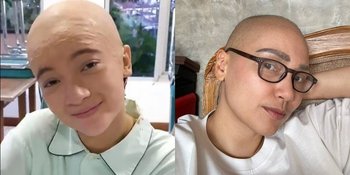 Deretan Artis Perempuan yang Pernah Tampil Botak, Berperan Jadi Gadis Idap Penyakit Kanker - Ada yang Usai Jalani Kemoterapi