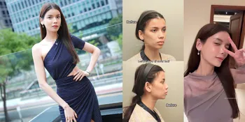 Dikira Oplas, 8 Potret Sabrina Chairunnisa Bongkar Rahasia Wajahnya yang Tirus dan Cekung Kini Berisi