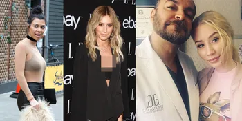 FOTO: 10 Selebriti Dunia Ini Tak Malu Akui Pernah Operasi Plastik
