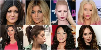 FOTO: Before-After Lip Injections, Bibir 9 Seleb Ini Makin Tebal