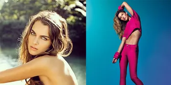 FOTO: Dibilang Kurang Cantik, 7 Wanita Ini Sukses Jadi Supermodel