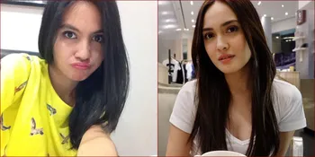 FOTO: Felya Sandra, Dokter Muda Cantik 'Kembaran' Shandy Aulia
