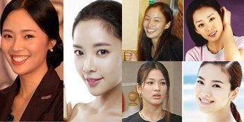 FOTO: Penampilan 8 Aktris Korea Sebelum Vs Sesudah Rapikan Gigi