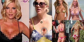 FOTO: Sederet Artis Ini Gagal Jalani Oplas, Masih Cantik & Hot?