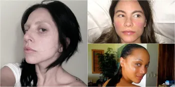 FOTO: Tak Pakai Make Up, Seleb Ini Terlihat Seperti Orang Biasa