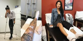 FOTO Tiga Setia Gara Ketika Rawat Lutut Hancur, Disebut Karena Ditendang Suami