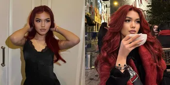 Hot Sejak Remaja, Ini 8 Potret Queennara Putri Liza Natalia yang Kelewat Cantik Hingga Sering Disangka Oplas - Momen Liburan di Turki Jadi Sorotan