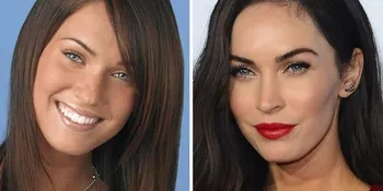Ini Dia Harga Operasi Plastik Para Seleb Hollywood, Mahal Banget!