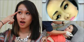 Inilah Perawatan Sulam Alis Felly Chibi Yang Habiskan Rp 12 Juta